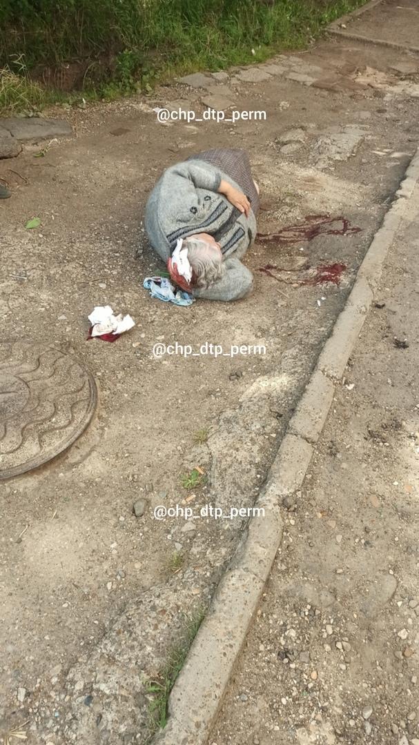 Прокуратура Пермского края проверяет факт несвоевременного оказания медпомощи пожилой пермячке