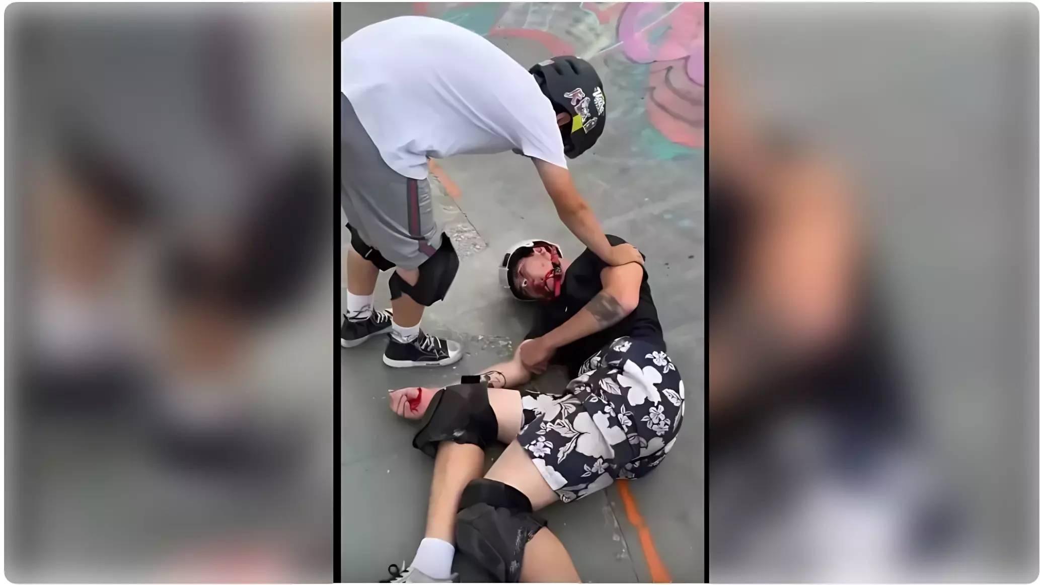 В пермском экстрим-парке профессиональный спортсмен получил серьёзную травму